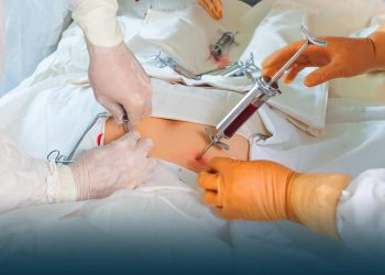 Doctors at SKIMS succeed in Bone Marrow Transplant