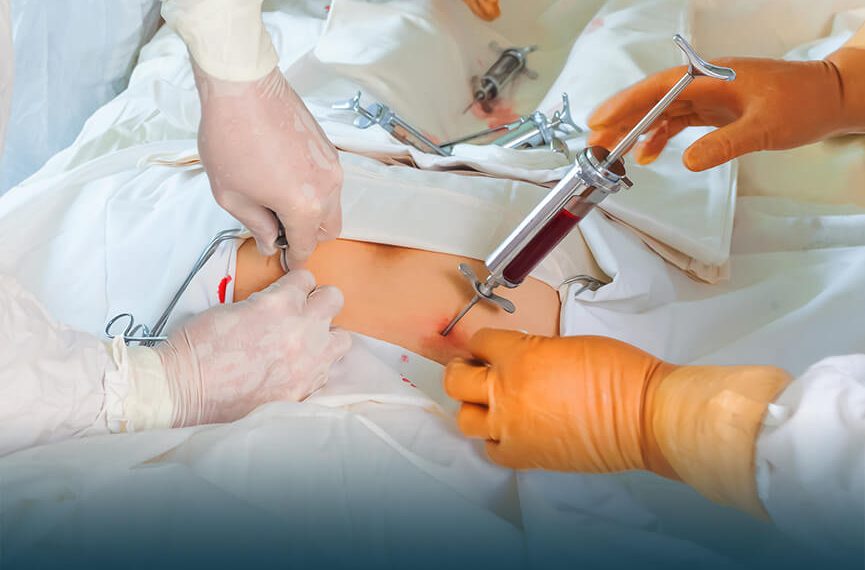 Doctors at SKIMS succeed in Bone Marrow Transplant