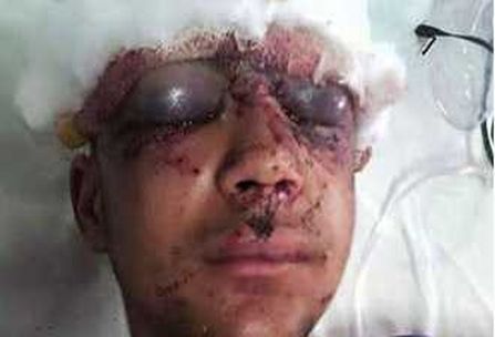 اُف،یہ اندھا کرنے والا پیلٹ گن!