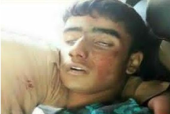 مظاہرین پر فائرنگ،2جاں بحق30 افراد زخمی