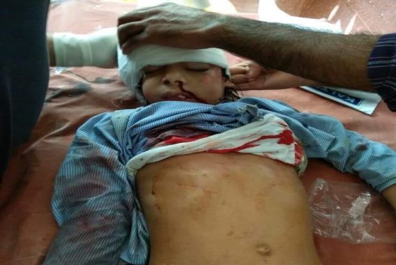 فوجی گاڑی کی ٹکر سے پھول سی بچی جاں بحق، شوپیاں میں احتجاج جاری