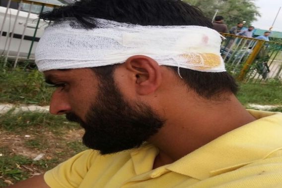 ہندوارہ ڈگری کالج پر فورسز کا دھاوا،کئی طلباءاور اساتذہ زخمی