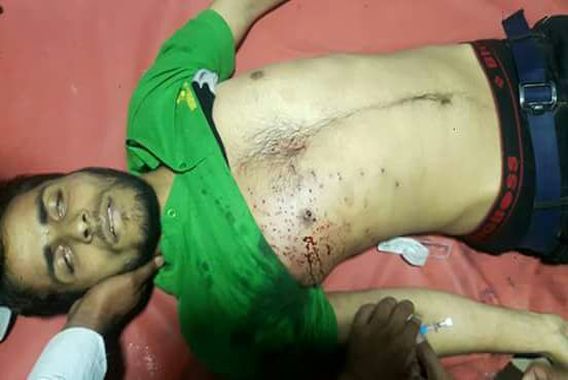 سی آر پی ایف نے پیلٹ چلا کر کاکہ پورہ کے لڑکے کو جاں بحق کردیا