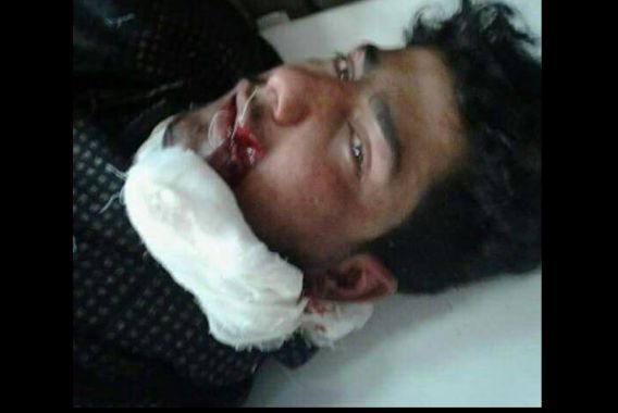 کولگام میں احتجاج،فوج نے نوجوان کو گولی مار دی