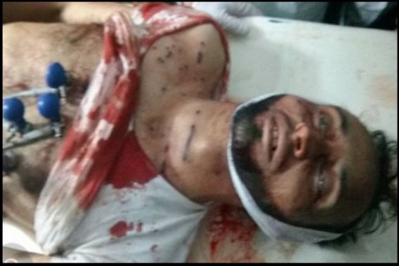 کشمیر کی عید بھی لہو لہو،2جاں بحق،درجنوں زخمی!