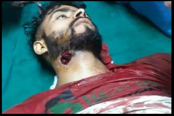 ترہگام میں فوج کی فائرنگ سے نوجوان جاں بحق!