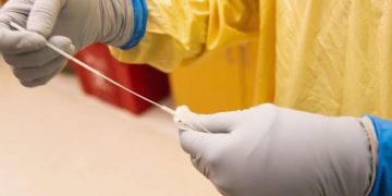 کرونا کے نمونے اب ناک سے نہیں شرم گاہ سے